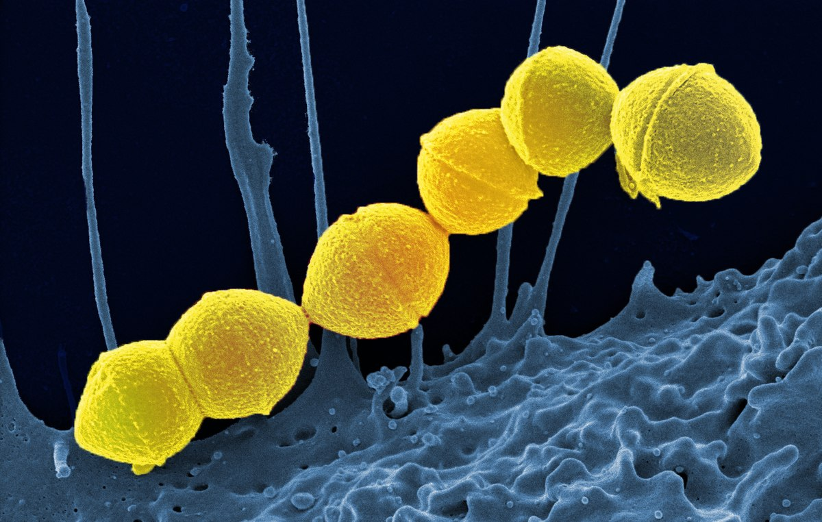 <p>Describe the cell wall component,<em> </em>which helps evade and penetrate host defenses, <em>streptococcus pyogenes.</em></p>
