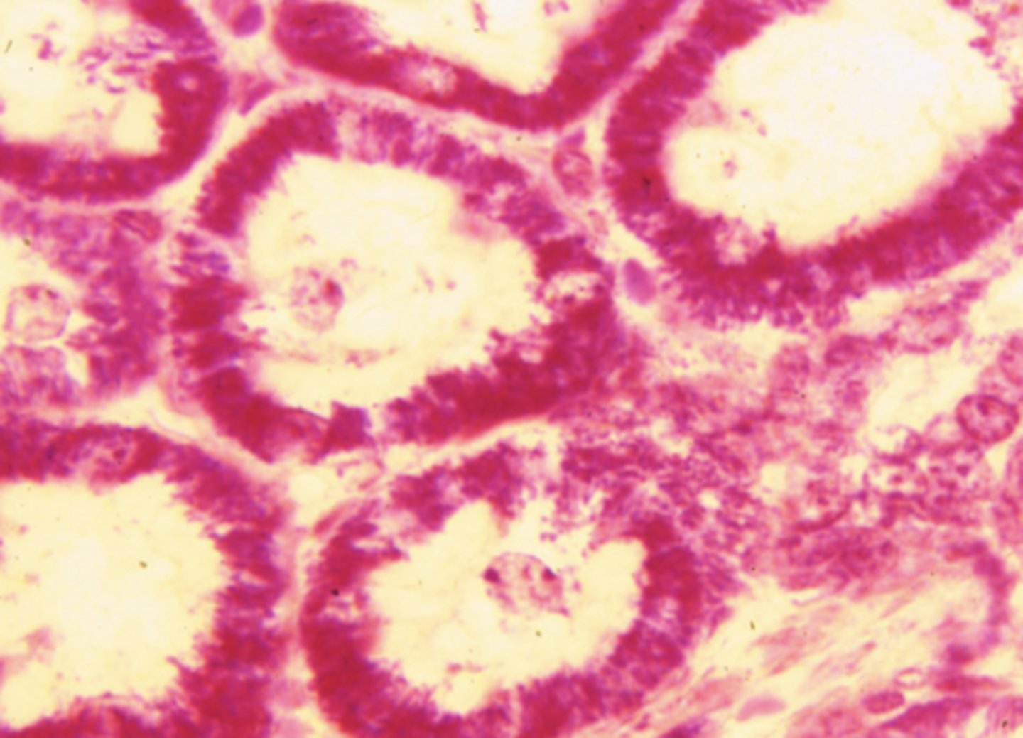 <p>what cell organelle is shown (stained with PTAH)</p>