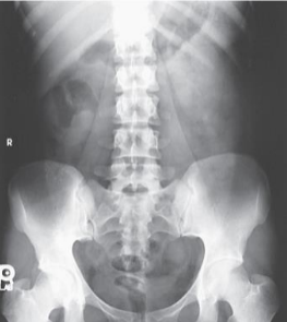 <p>Projection?</p>