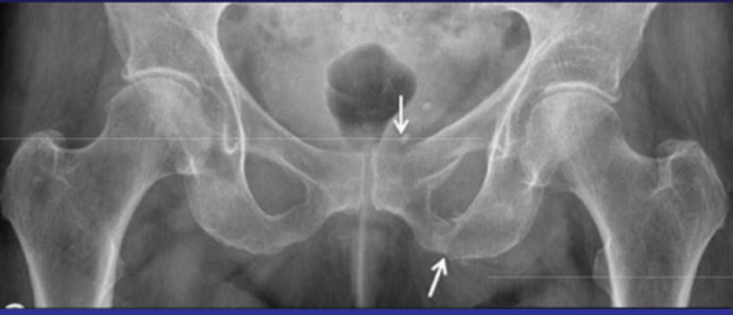 <p>What pathology is this?</p>