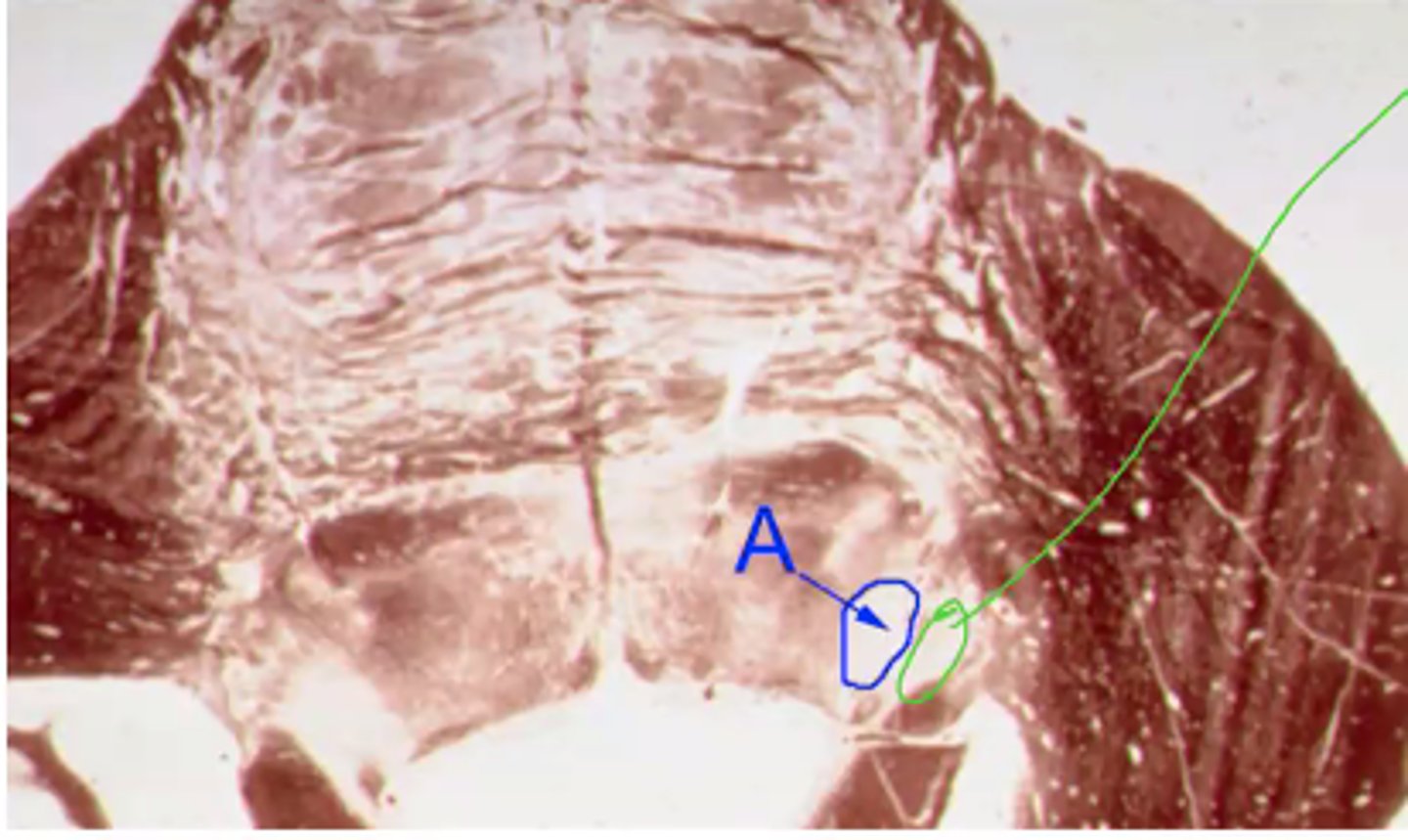 <p>Identify the structures indicated by the green outline</p>