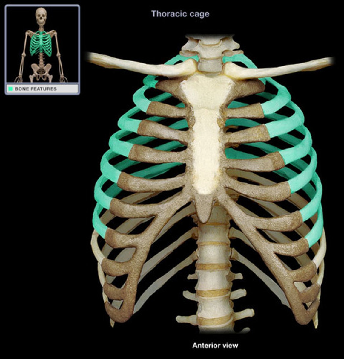 <p>first 7 pairs of ribs; attach directly to sternum</p>