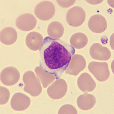 <p>What is this leukocyte?</p>
