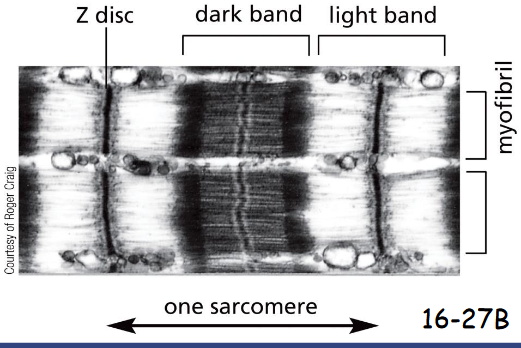 <p>the attachment sites for the plus end of actin filaments.</p>