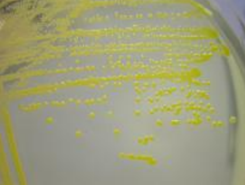 <p>What does this image show?</p>