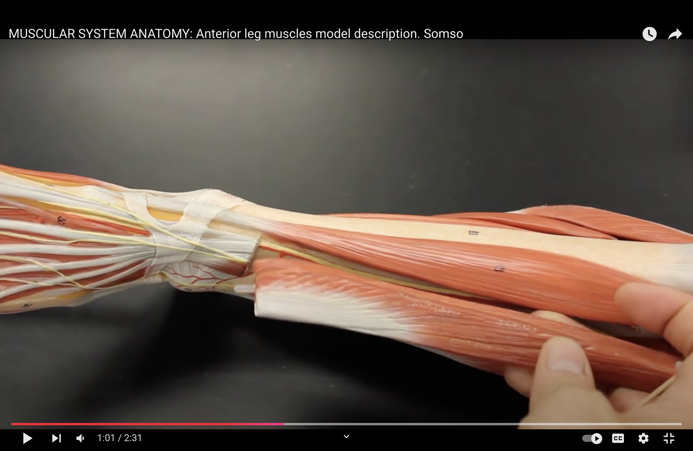 <p>What muscle is this?*****</p>