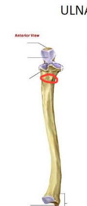 <p>ulna, dents below open mouth of “C” on shaft</p>