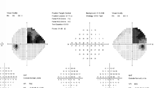 <p>What is this VF plot showing</p>