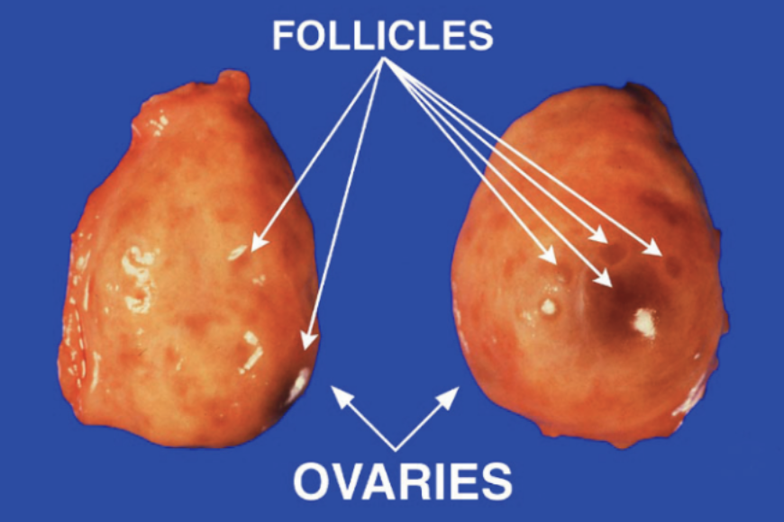 <p>types of follicles</p><p>tertiary follicle (developing antral follicle)</p>