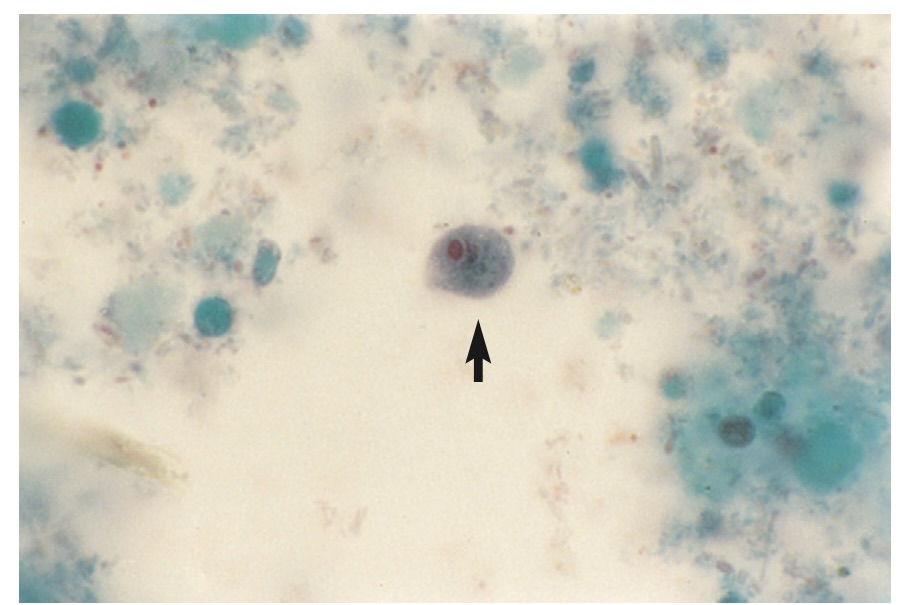 <p>A non-pathogenic protozoan intestinal parasite.</p>