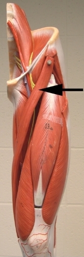 <p>Name the muscle indicated by the arrow</p><p>View: anterior side of the thigh</p>