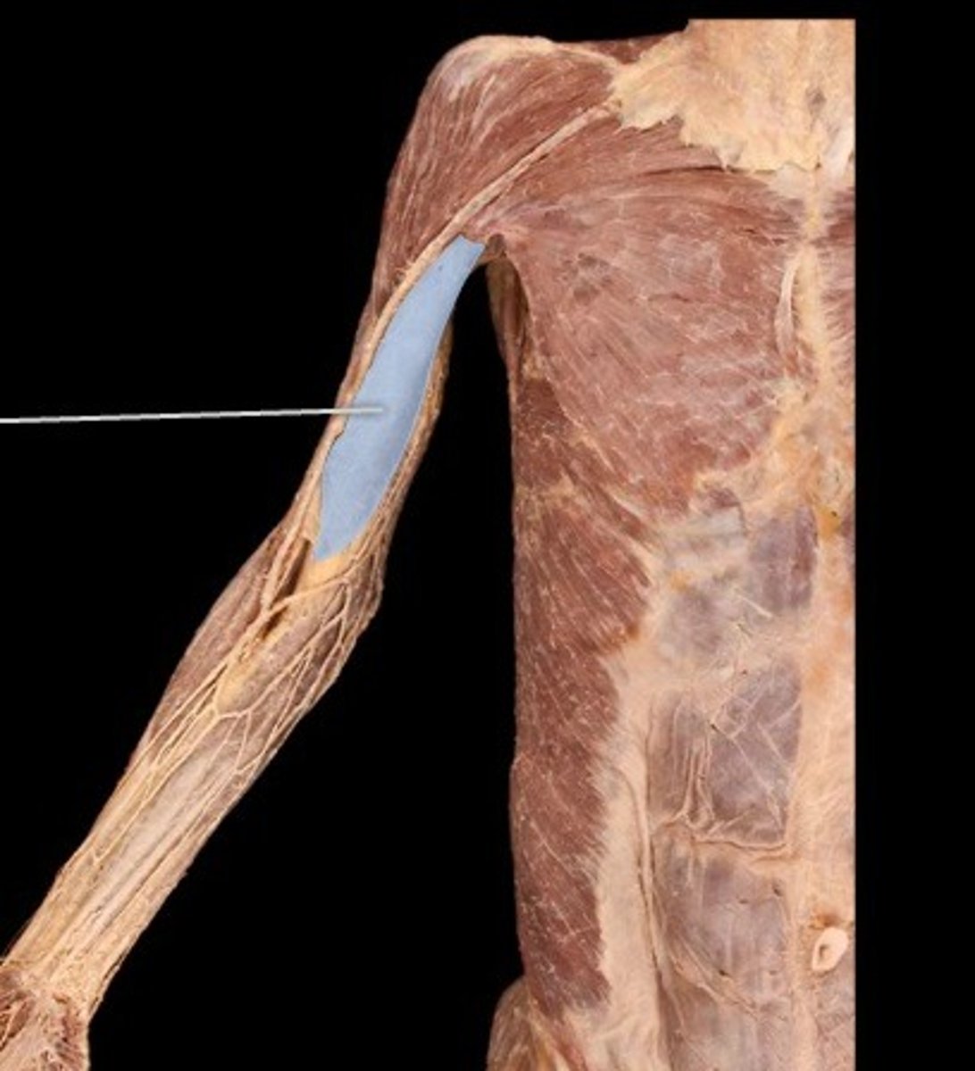 <p>What muscle is this?</p>