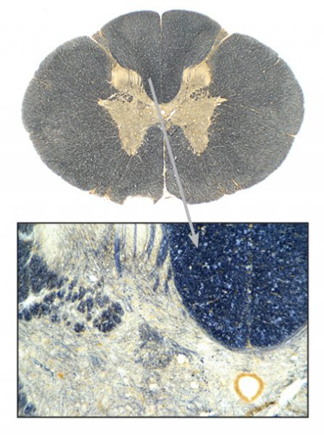 term image