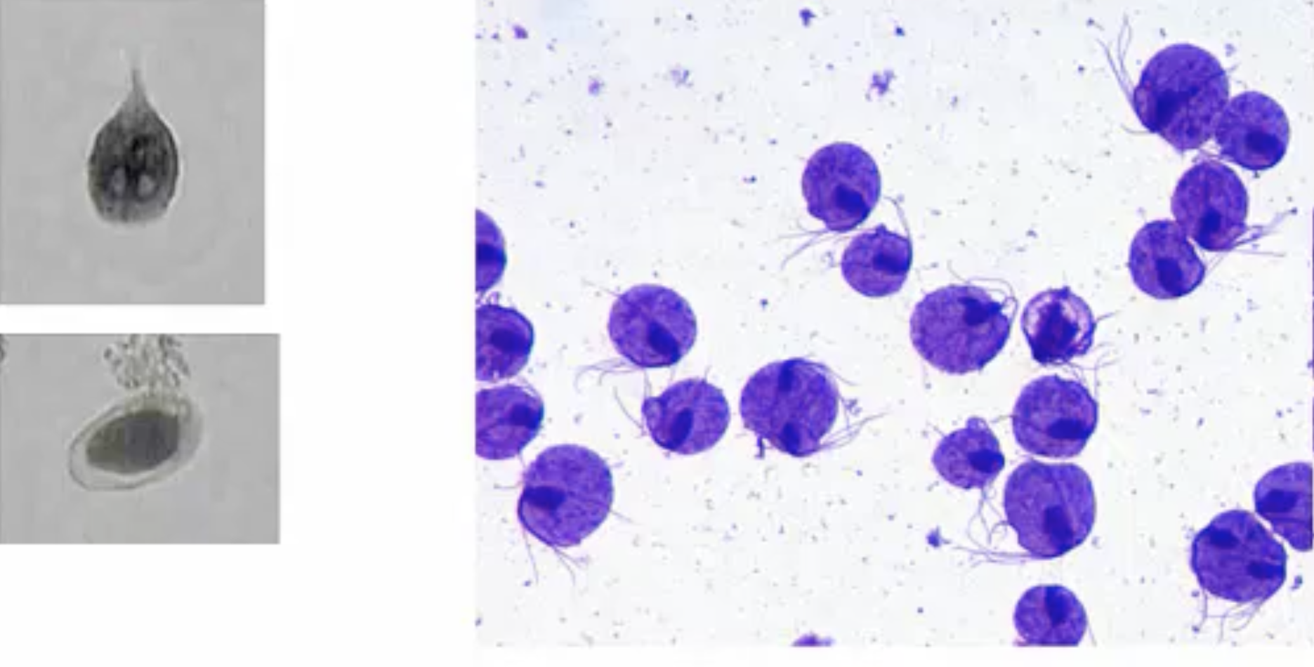 <p>Organisms in phylum Archaeozoa lack ________ and therefore must live in an _____ ______,</p>