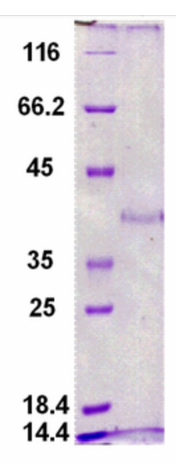 A student prepared a PAGE gel of their unknown protein (see picture, right lane). In the left lane, a molecular weight size marker was added.

Estimate the MW of the protein represented by the band in the right lane.