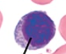 <p>what type of blood cell is this?</p>