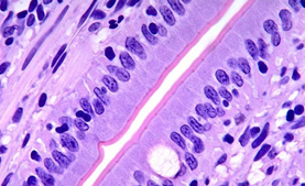 <p>= parte a p. apical</p><p>= proiecții digitiforme care măresc suprafța apicală și facilitează absorbția (ex: <em>platoul striat</em> al epiteliului intestinal)</p>