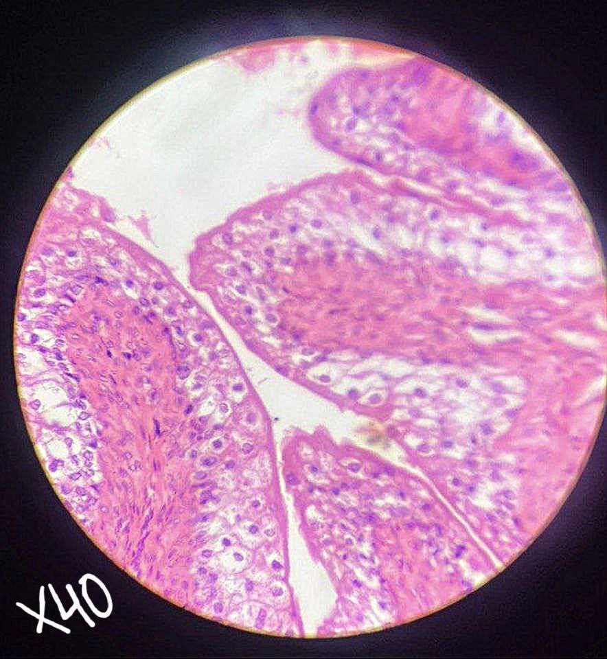 <p>Identify the tissue and mention one site</p>