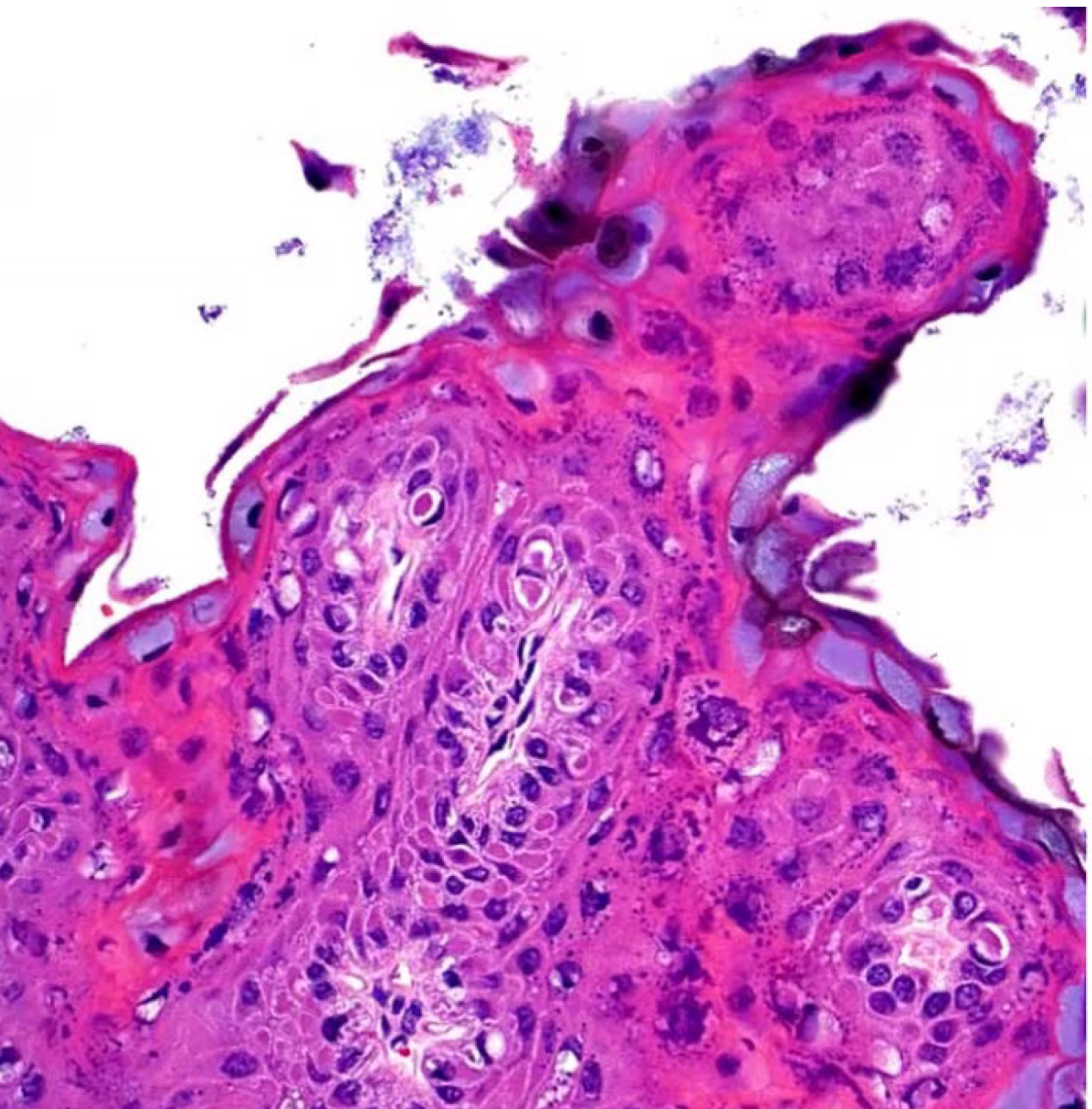 <p>A-Foot and mouth disease virus</p><p>B-Bovine viral diarrhea virus</p><p>C-Papular stomatitis virus</p><p>D-lnfectious rhinotracheitis virus</p>