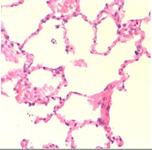 <p>Identify this epithelial tissue, where it is found, and its function.</p>