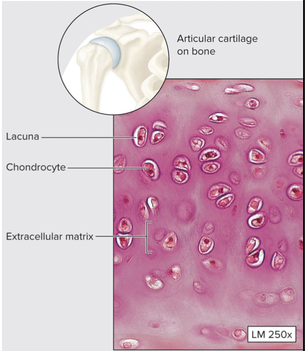 * Glassy matrix; chondrocytes in lacunae; usually covered by **perichondrium**
* Most common type of cartilage, but also the weakest
* Smooths joint surfaces, model for bone growth
* Covers articular ends of long

  bones; most of the larynx,

  trachea, nose