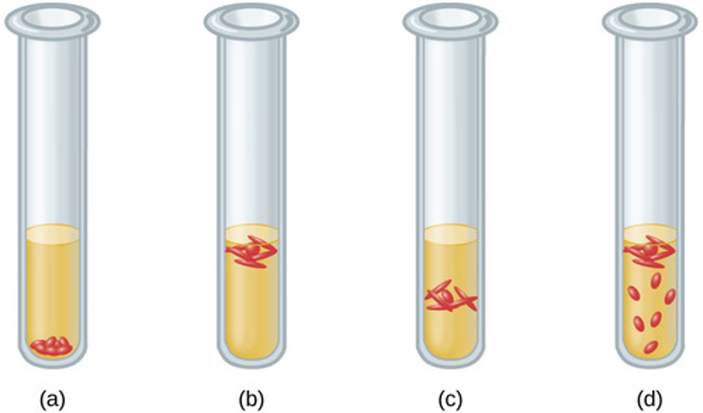 <p>28. (a) obligate anaerobe, (b) obligate aerobe, (c) microaerophile, (d) facultative anaerobe</p>