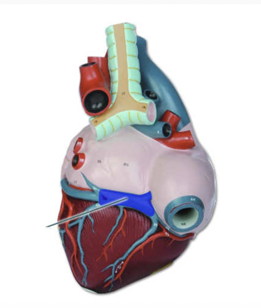 <p>Identify the highlighted structure.</p>