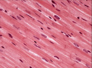 <p>Label the Cardiac Muscle </p>