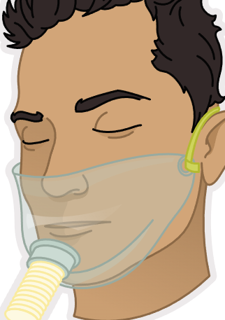 <p><strong>Aerosol Mask, Face Tent, Tracheostomy Collar</strong></p>