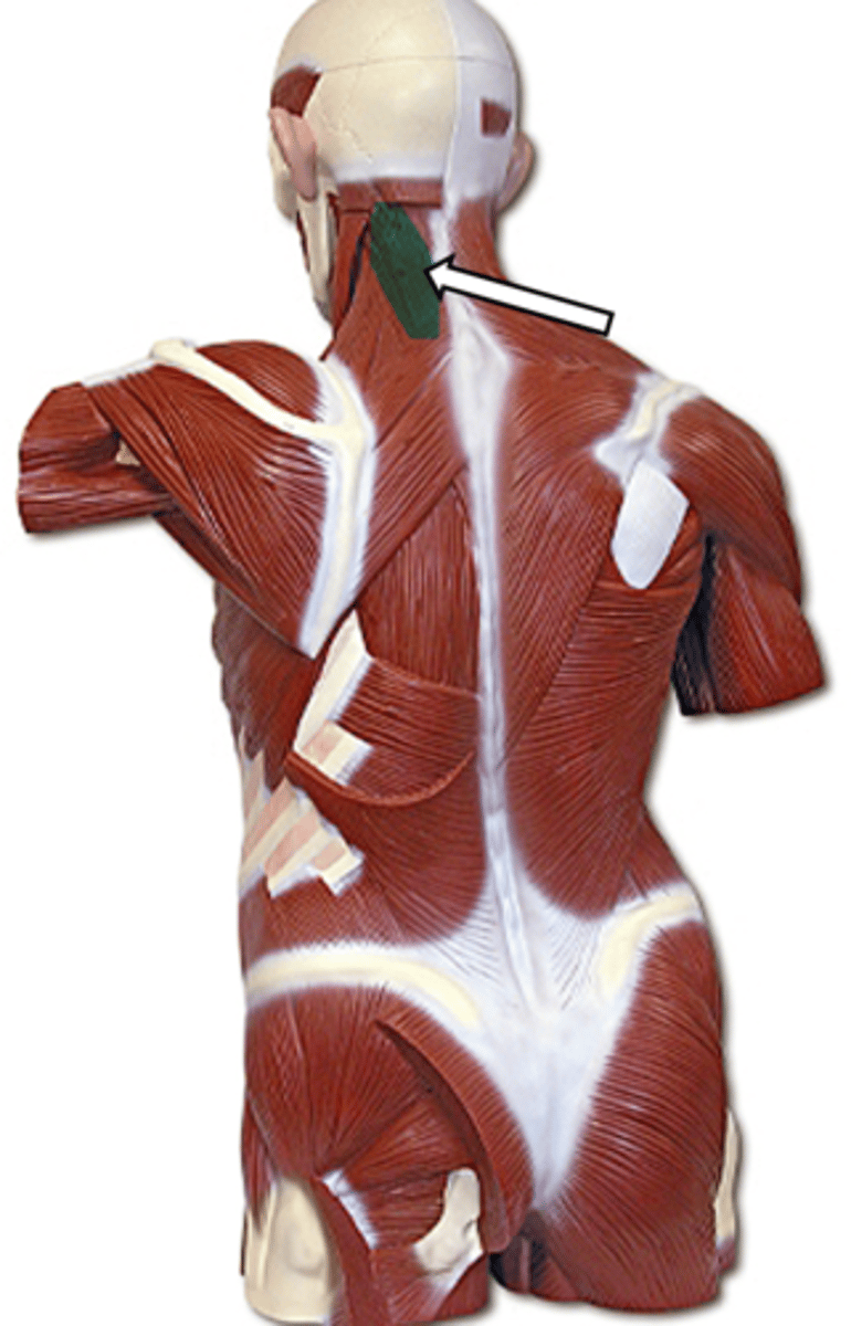 <p>name the muscle</p>