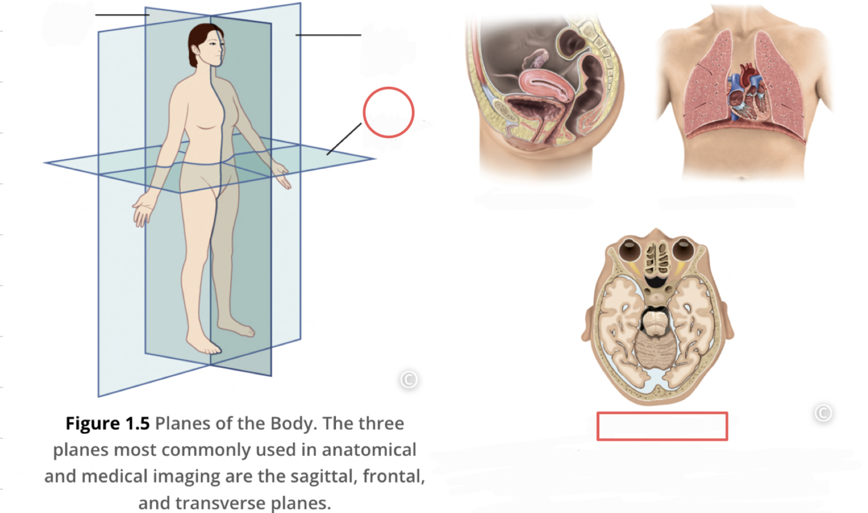 <p>divides body or organ horizontally into upper and lower portions, produce cross sections</p>