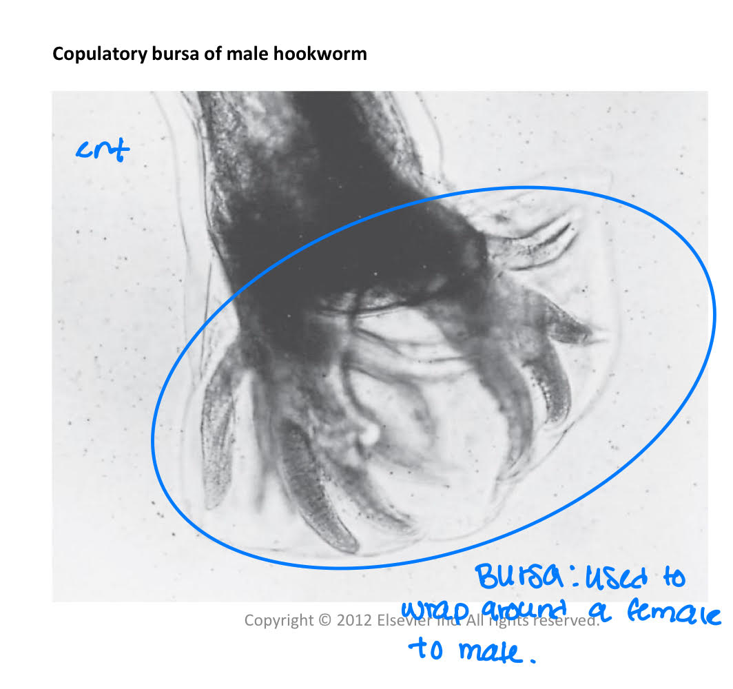 <p>*dioecious + sexually dimorphic (male and female look different) </p><ul><li><p>testes</p></li><li><p>sperm (pseudopodia) </p></li><li><p>bursa (used to wrap around a female to mate) </p></li></ul><p></p>