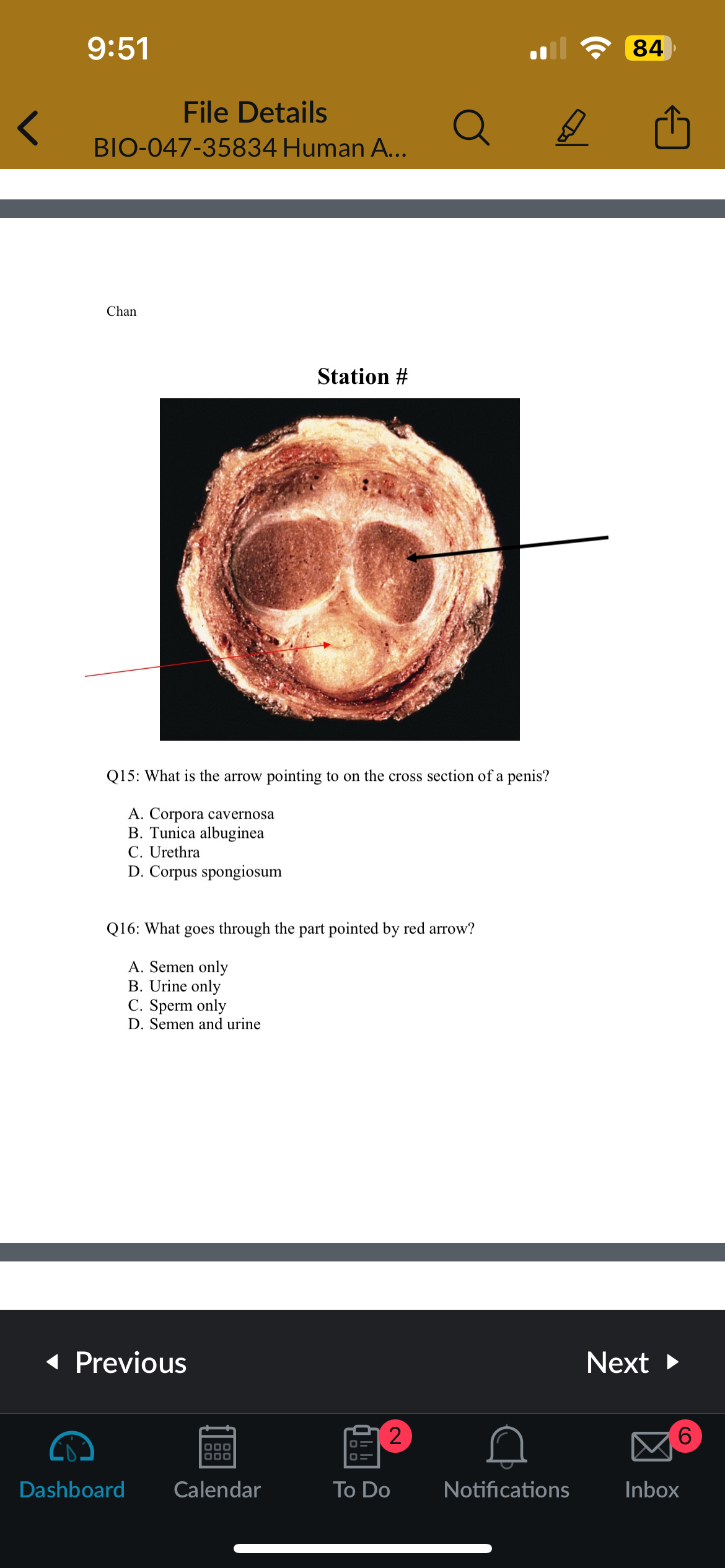 <p>Q16: What goes through the part pointed by the red arrow?</p>