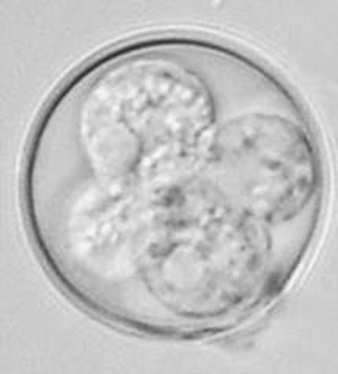 <p>This structure was found on the fecal flotation of a goat. What is it?</p>