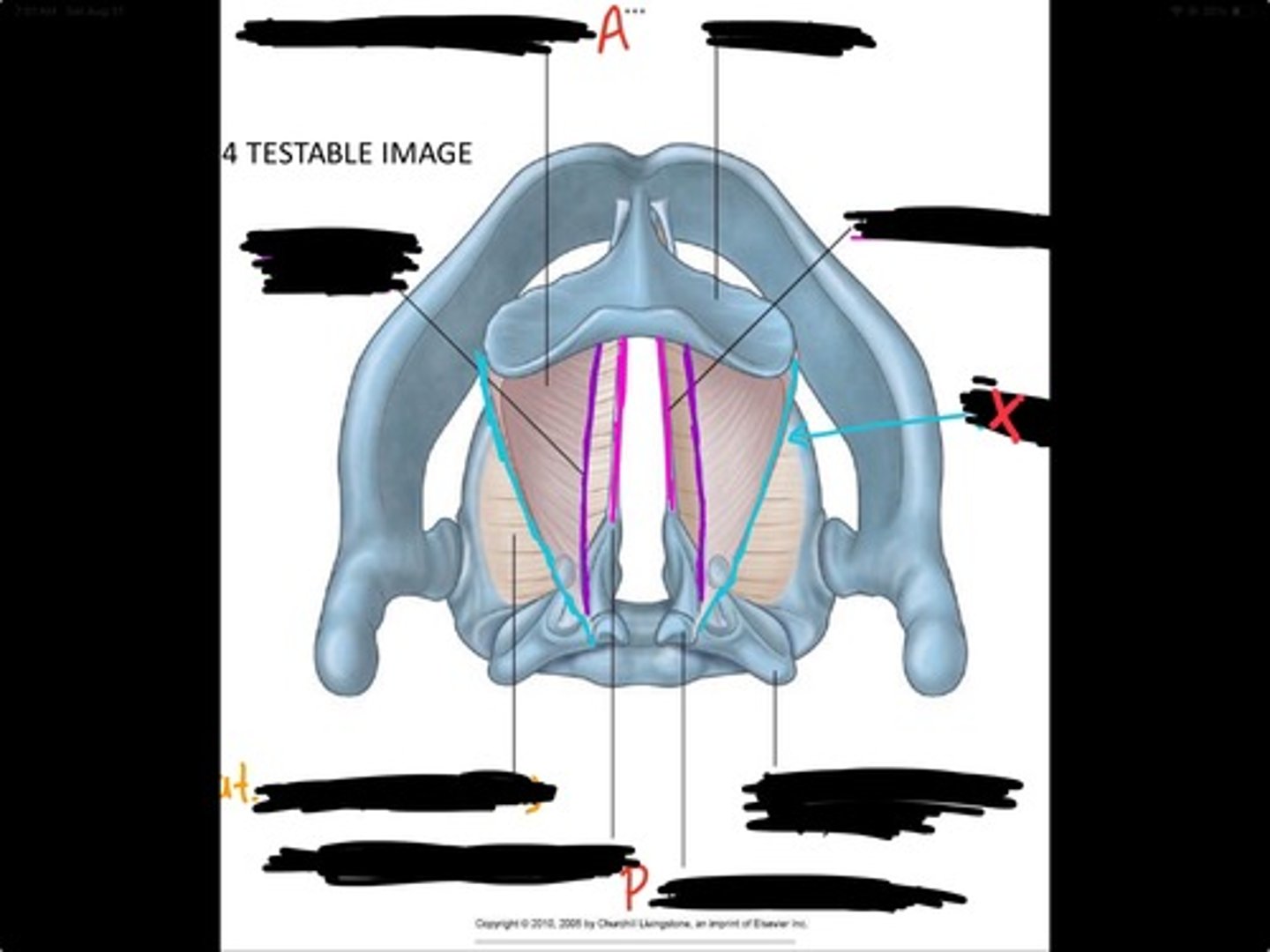 knowt flashcard image