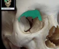 <p>Internal surface on upper part of eye orbit</p>