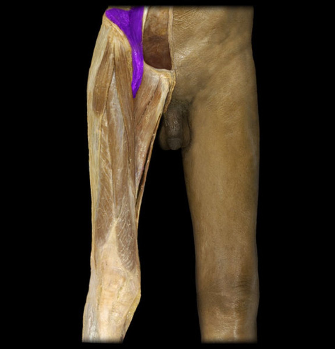 <p>Origin: Lumbar vertebra, iliac crest and fossa</p><p>Insertion: Lesser trochanter of femur</p><p>Action: Flexes thigh (powerful)</p>
