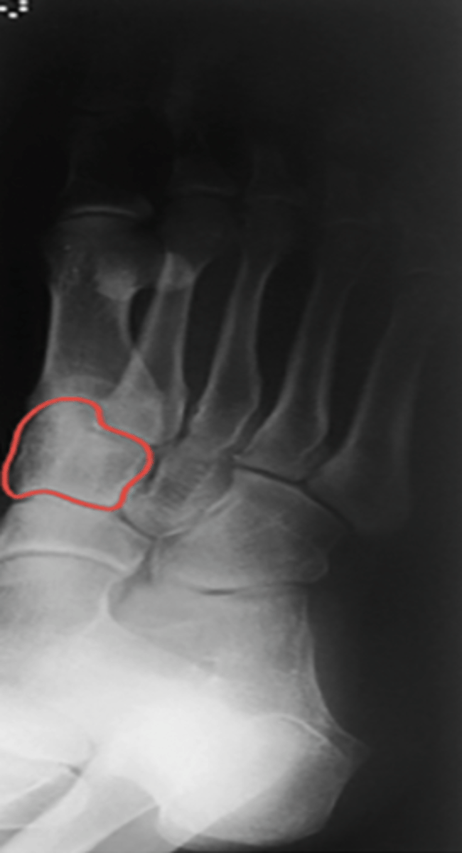 <p>What structure is highlighted?</p>