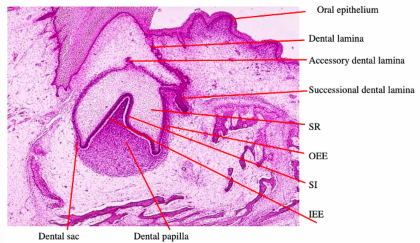 <p>-IEE: single layer of low columnar epithelial cells, lines inner concave surface of enamel organ and is separated by the basal lamina from the dental papilla, will differentiate into ameloblasts</p><p>-SI: 1-4 layers of squamous epithelial cells, immediately adjacent and external to IEE, support ameloblasts during amelogenesis</p><p>-SR: stellate shaped cells with cell bodies far apart, support ameloblasts during amelogenesis, release proteoglycans and heparin → pressure to maintain the shape of the tooth, transports nutrients between IEE and OEE<br>-OEE: single layer of low columnar almost squamous epithelial cells, lines the outer convex surface of the enamel organ, separated by a basal lamina from the dental sac, protective, exchange with blood vessels</p><p>-dental papilla (condensed mesenchyme): beneath IEE, cells become odontoblasts (dentin)</p><p>-dental follicle (condensed mesenchyme): around enamel organ, forms cementum/PDL/alveolar bone&nbsp;</p>