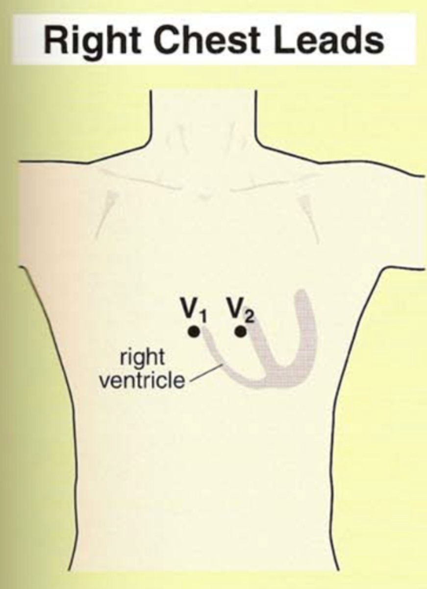 <p>Over right side of heart</p>