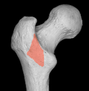 <p>posterior area that connects femur trochanters </p>