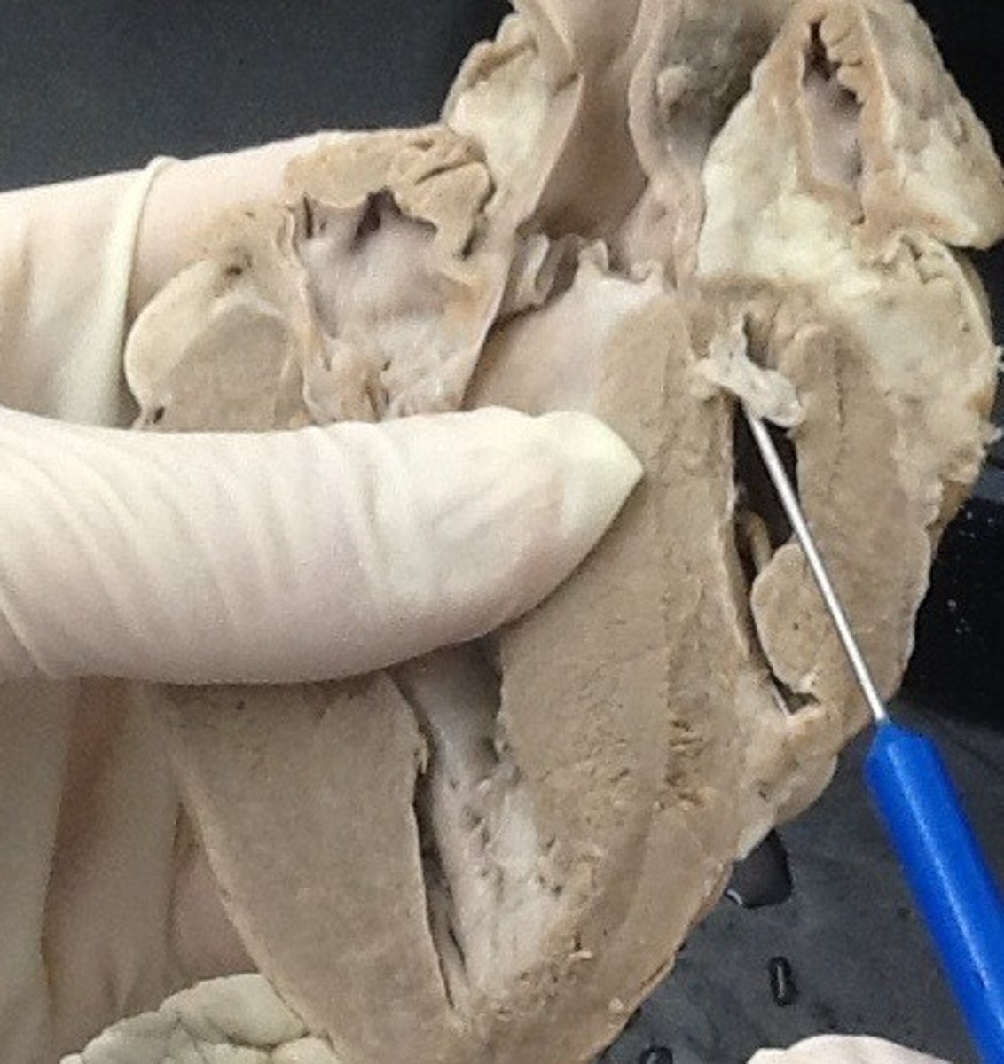 <p>Identify:heart valve opening from the right ventricle to the pulmonary artery</p>