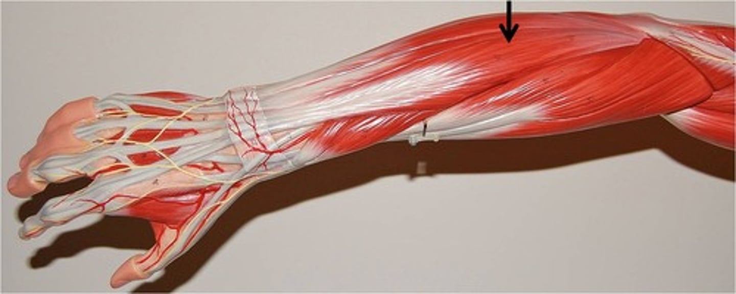 <p>Action: extension of fingers<br><br>Origin: lateral epicondyle of humerus <br><br>Insertion: distal phalanges of fingers 2-5</p>