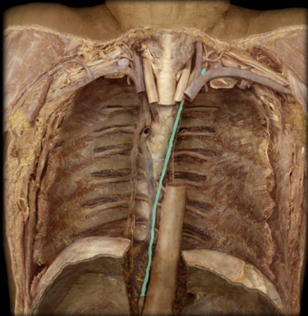 <p>What lymphatic structure is highlighted in this image?</p>