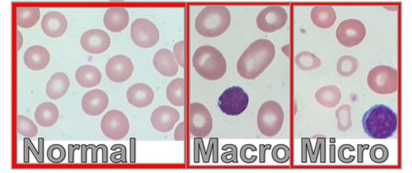 <p>classify RBC by size and Hb content (RBC, Hct, Hb)</p>
