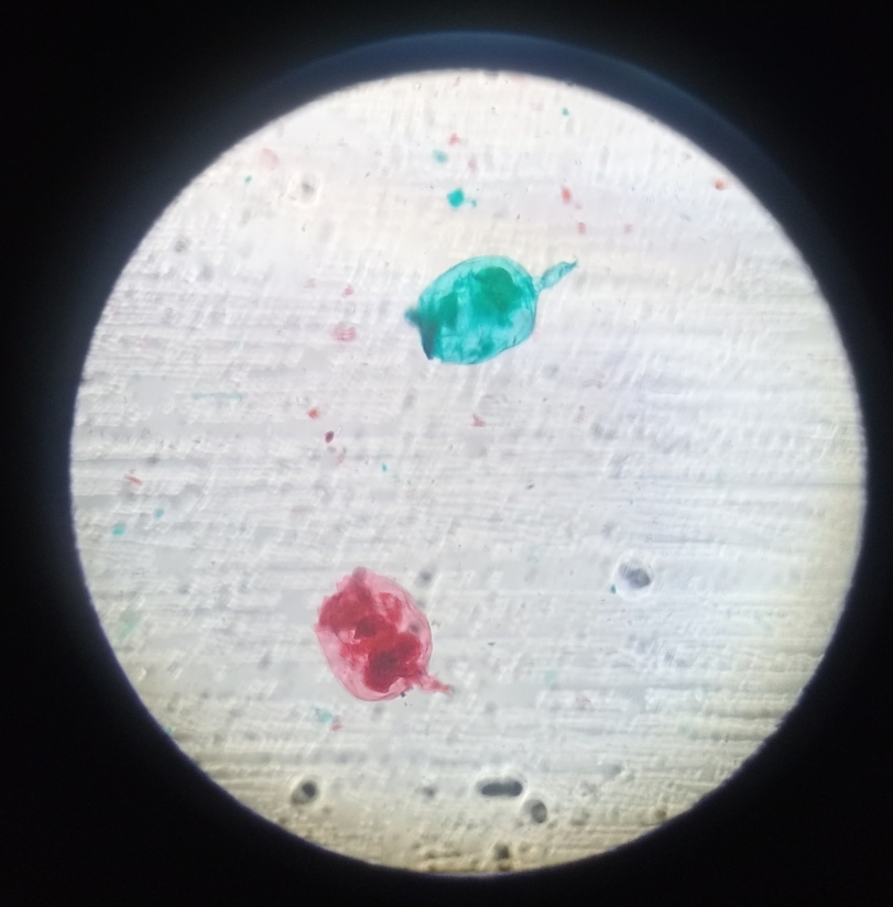 <p>Its name comes from a Latin word meaning “wheel” and -fer meaning “bearing” or “carrying,” referring to the wheel-like ciliated corona at its head used for locomotion and feeding.</p>