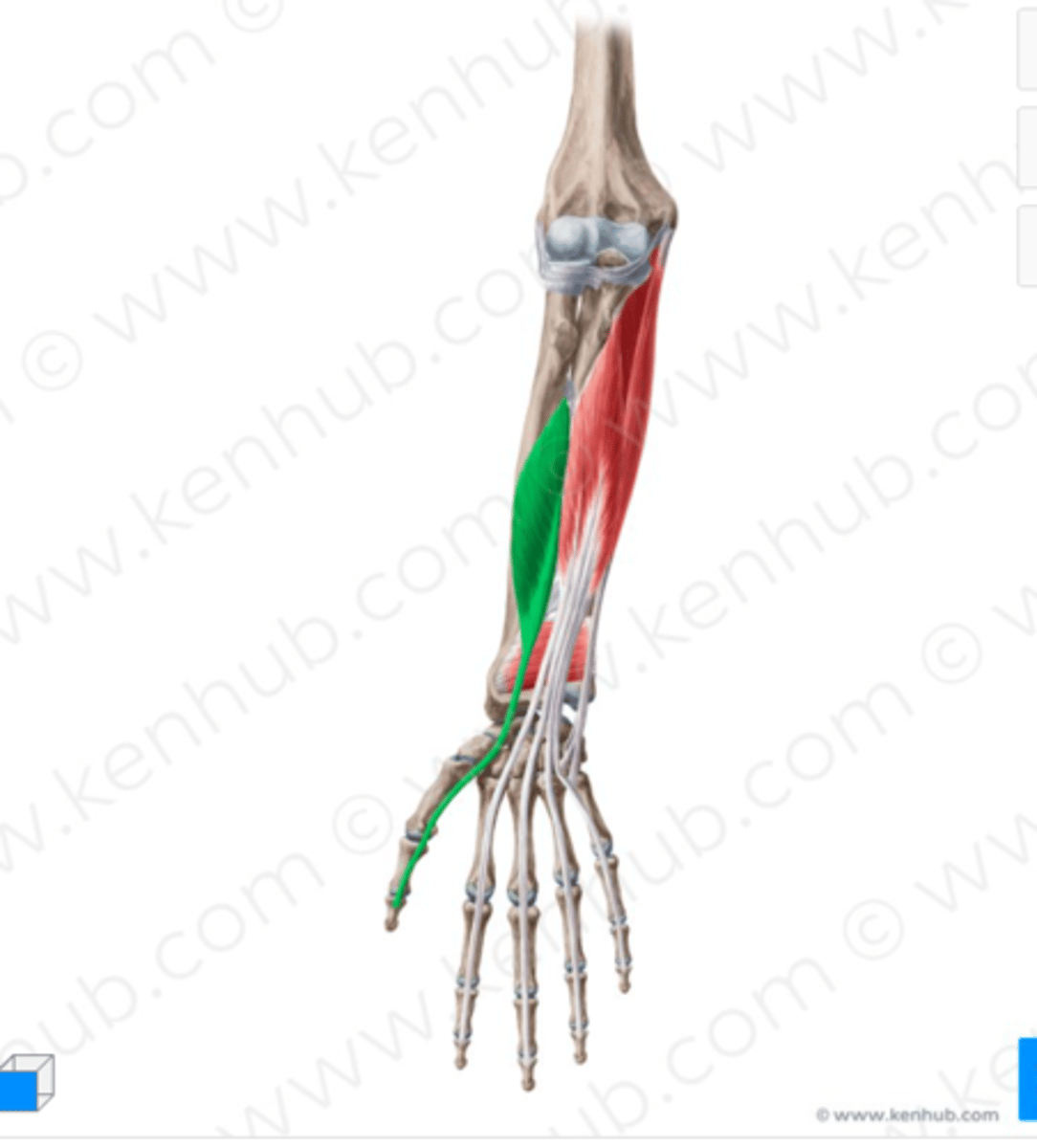 <p>Welke spier is dit?</p>