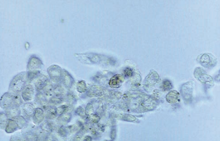 Syncytia of transitional epithelial cells