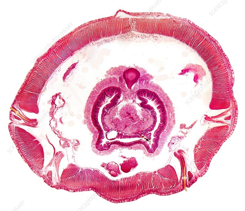 <p>Based off the picture, which phylum does this organism belong to?</p>