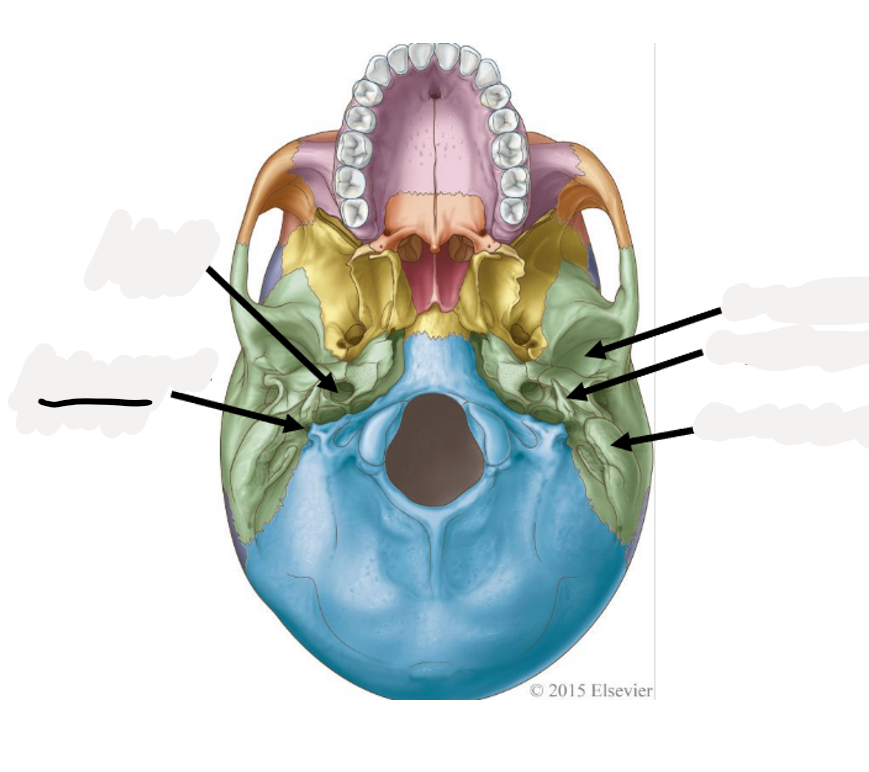 <p>Facial nerve (CN VII) exits here</p>